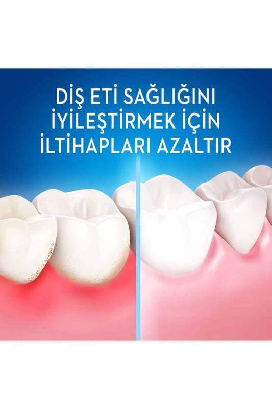 Oral-B UltraThin Precision Gum Care Black Diş Fırçası - 3